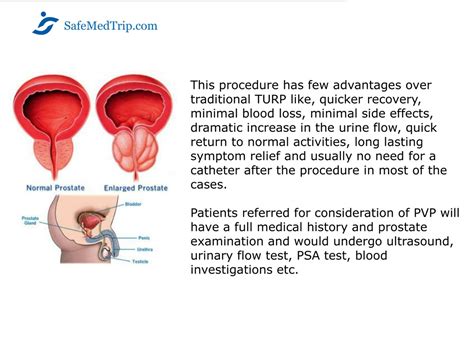 pvp medical abbreviation|pvp surgery on prostate.